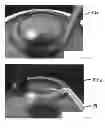 Fig. 07 - ANNULAR KERATOPIGMENTATION SYSTEMS AND METHODS OF VISION CORRECTION OF PRESBYOPIC EYES