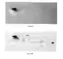 Fig. 06 - Method for modifying the refractive index of ocular tissues