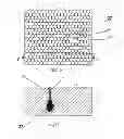 Fig. 04 - Aesthetic treatment device and method