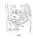 Fig. 16 - Systems and methods for prostate treatment