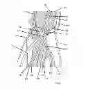 Fig. 02 - Devices and methods for fistula formation