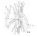 Fig. 04 - Devices and methods for fistula formation