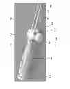 Fig. 06 - Devices and methods for fistula formation