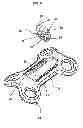Fig. 07 - Orthopaedic plate and spreader apparatuses and methods
