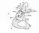 Fig. 01 - Patient-specific acetabular guides and associated instruments