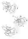 Fig. 02 - Patient-specific acetabular guides and associated instruments