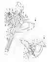Fig. 04 - Patient-specific acetabular guides and associated instruments