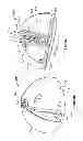 Fig. 06 - Patient-specific acetabular guides and associated instruments