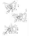 Fig. 08 - Patient-specific acetabular guides and associated instruments
