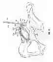 Fig. 09 - Patient-specific acetabular guides and associated instruments