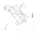Fig. 02 - Method and apparatus for hip replacements