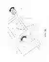 Fig. 13 - Method and apparatus for hip replacements