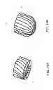 Fig. 15 - Method and apparatus for hip replacements