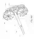 Fig. 18 - Method and apparatus for hip replacements