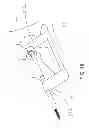 Fig. 21 - Method and apparatus for hip replacements