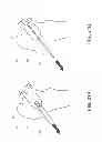 Fig. 24 - Method and apparatus for hip replacements