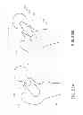 Fig. 27 - Method and apparatus for hip replacements