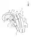 Fig. 02 - Customized arthroplasty cutting guides and surgical methods using the same