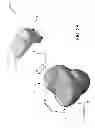 Fig. 03 - Customized arthroplasty cutting guides and surgical methods using the same