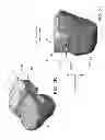 Fig. 04 - Customized arthroplasty cutting guides and surgical methods using the same