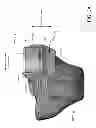 Fig. 05 - Customized arthroplasty cutting guides and surgical methods using the same