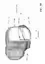 Fig. 06 - Customized arthroplasty cutting guides and surgical methods using the same