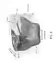 Fig. 08 - Customized arthroplasty cutting guides and surgical methods using the same