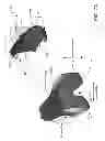Fig. 10 - Customized arthroplasty cutting guides and surgical methods using the same