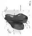 Fig. 12 - Customized arthroplasty cutting guides and surgical methods using the same