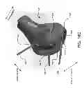 Fig. 16 - Customized arthroplasty cutting guides and surgical methods using the same