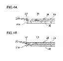 Fig. 05 - Instrument for inserting intraocular lens