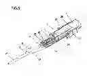 Fig. 06 - Instrument for inserting intraocular lens