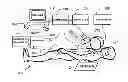 Fig. 01 - Electrostriction devices and methods for assisted magnetic navigation