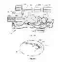 Fig. 02 - Electrostriction devices and methods for assisted magnetic navigation