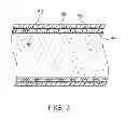 Fig. 04 - DEVICES AND METHODS FOR ACCESSING A CEREBRAL VESSEL