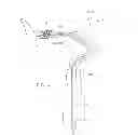 Fig. 05 - DEVICES AND METHODS FOR ACCESSING A CEREBRAL VESSEL