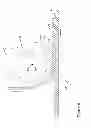Fig. 07 - Skin graft preparation device