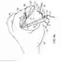 Fig. 16 - HANDHELD SAFETY SUTURING DEVICE