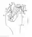 Fig. 19 - HANDHELD SAFETY SUTURING DEVICE