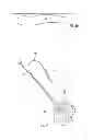 Fig. 04 - Suture Passer and Subcortical Knot Placement