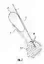 Fig. 05 - Suture Passer and Subcortical Knot Placement