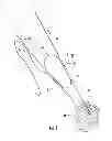 Fig. 07 - Suture Passer and Subcortical Knot Placement