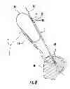 Fig. 08 - Suture Passer and Subcortical Knot Placement