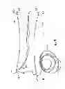 Fig. 09 - Suture Passer and Subcortical Knot Placement