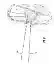 Fig. 15 - Suture Passer and Subcortical Knot Placement
