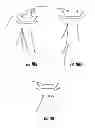 Fig. 16 - Suture Passer and Subcortical Knot Placement