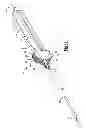Fig. 02 - Wheeled suture passer
