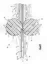 Fig. 05 - Wheeled suture passer
