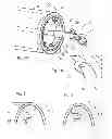Fig. 02 - Device and method for removing tissue inside a body vessel