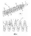 Fig. 02 - Helical fibrin removal tool